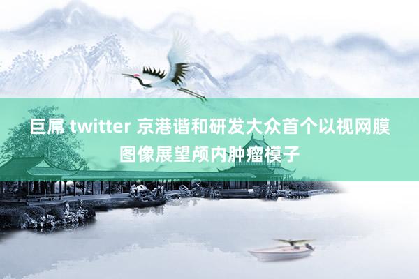 巨屌 twitter 京港谐和研发大众首个以视网膜图像展望颅内肿瘤模子